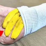 Banana Peel On Your Feet A Surprising Natural Remedy You’ll Love