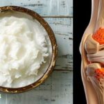 Foods To Rebuild Knee Cartilage This Is What You Should Eat!